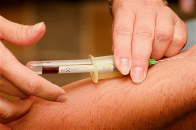 Spinal Needle + سازنده: روندهای صنعت و چشم انداز چالش های آینده