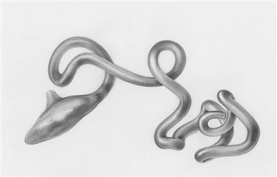 ارزش اصلی سوزن های سوراخ کننده ستون فقرات از دیدگاه بالینی چند رشته ای